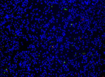 Cell Meter™ Apoptotic and Necrotic Multiplexing Detection Kit *Triple Fluorescence Colors*