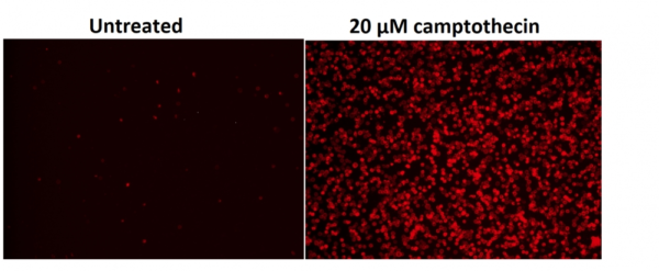 apoptosis