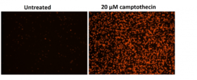 Kit de ensayo Cell Meter™ de apoptosis de fosfatidilserina