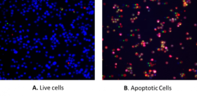 Kit II de detección de multiplexación apoptótica y necrótica Cell Meter™